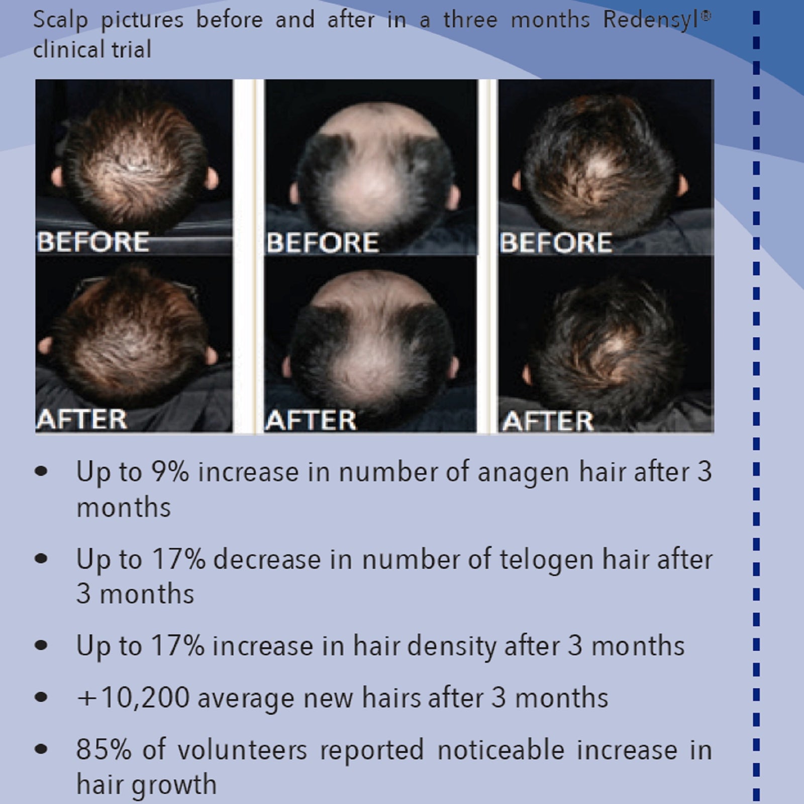 REGENSIFY Regrowth Serum Bundle Set