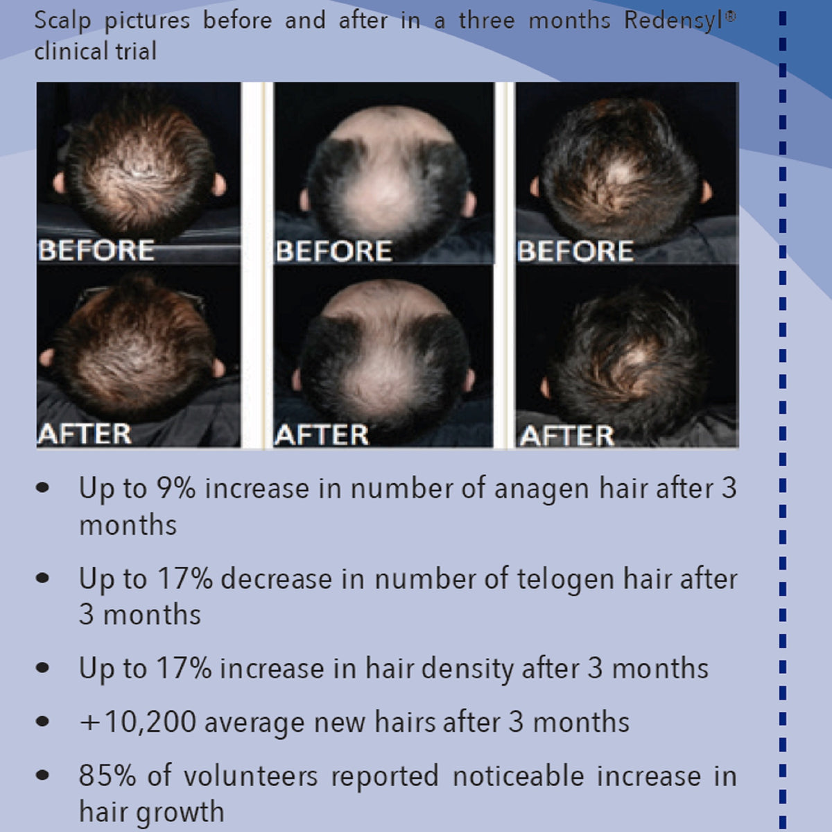 REGENSIFY Regrowth Serum Bundle Set